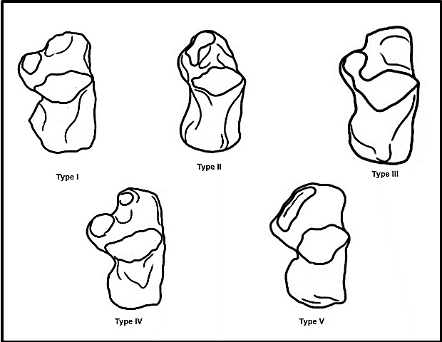 Schematic illustration of calcaneal articular facets