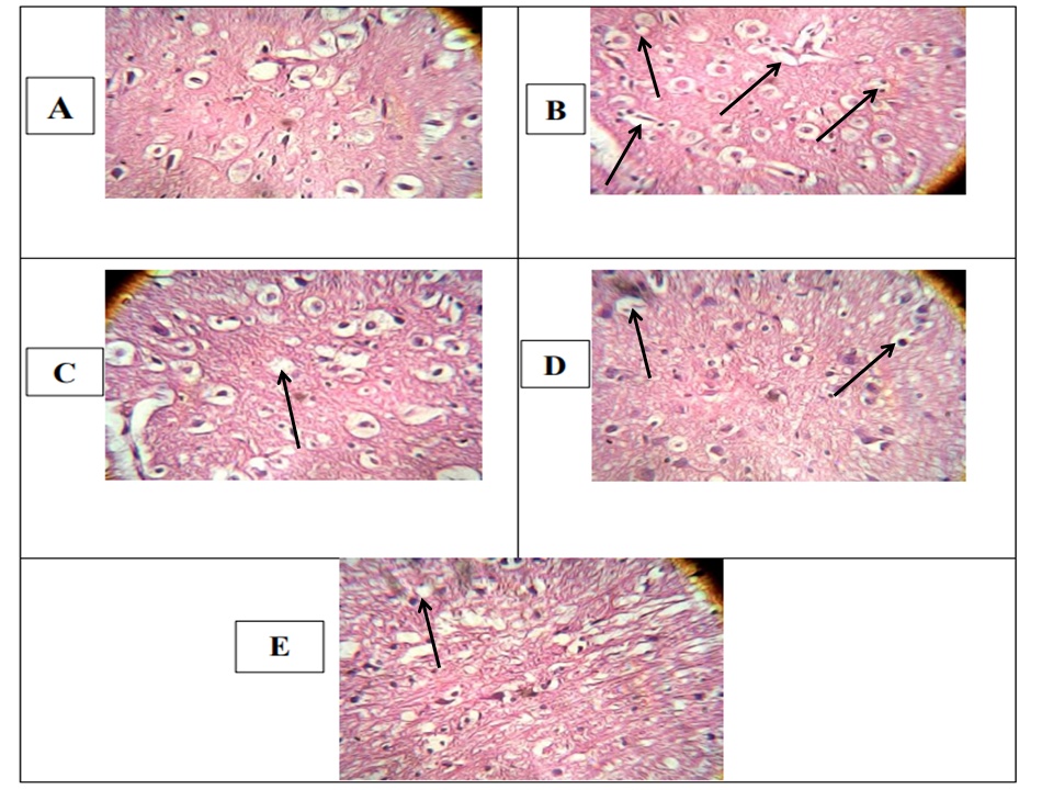 Histopathological analysis results (A) Normal control group, (B) Disease control group, (C) Standard (donepezil) treated group, (D) H.E.L.S. 100 mg/kg treated group, and (E) H.E.L.S. 300mg/kg treated group.