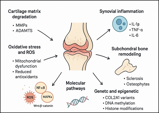 Overview of the pathophysiology of osteoarthritis.